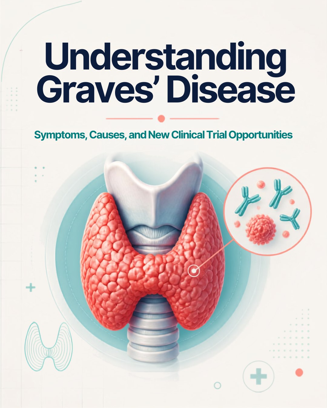 Illustration of an inflamed, overactive thyroid gland with an inset showing antibodies attacking thyroid cells. Headline: Understanding Graves’ Disease — symptoms, causes, and new clinical trial opportunities.